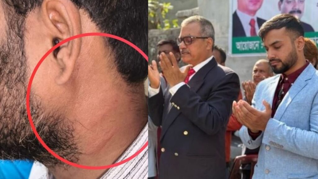 জামায়াত নেতার ওপর হামলা, বিএনপি প্রার্থীর ছেলেকে ইসির তলব
